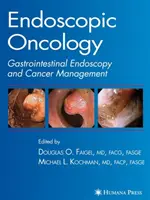 Endoskopická onkológia - Endoscopic Oncology