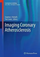 Zobrazovanie koronárnej aterosklerózy - Imaging Coronary Atherosclerosis