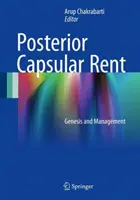 Zadná kapsulárna renta: genéza a manažment - Posterior Capsular Rent: Genesis and Management