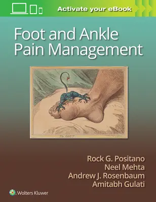 Manažment bolesti nohy a členka - Foot and Ankle Pain Management