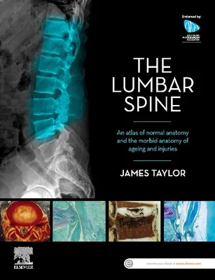 Bedrová chrbtica: Atlas normálnej anatómie a morbídnej anatómie starnutia a úrazov - The Lumbar Spine: An Atlas of Normal Anatomy and the Morbid Anatomy of Ageing and Injury