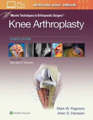 Majstrovské techniky v ortopedickej chirurgii: Artroplastika kolena - Master Techniques in Orthopedic Surgery: Knee Arthroplasty