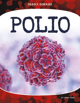 Poliomyelitída - Polio
