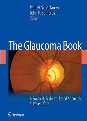 Kniha o glaukóme: Praktický prístup k starostlivosti o pacienta založený na dôkazoch - The Glaucoma Book: A Practical, Evidence-Based Approach to Patient Care
