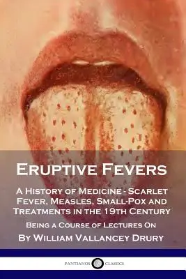Erupčné horúčky: Dějiny medicíny - Šarlach, osýpky, kiahne a liečba v 19. storočí - kurz prednášok - Eruptive Fevers: A History of Medicine - Scarlet Fever, Measles, Small-Pox and Treatments in the 19th Century - Being a Course of Lectu