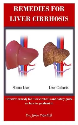 Lieky na cirhózu pečene: Účinné prostriedky proti cirhóze pečene a bezpečnostný návod, ako postupovať - Remedies For Liver Cirrhosis: Effective remedies for liver cirrhosis and safety guide on how to go about it