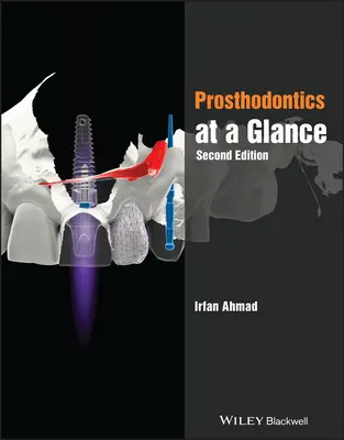 Protetika v skratke - Prosthodontics at a Glance