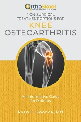 Možnosti nechirurgickej liečby osteoartrózy kolena: Informatívny sprievodca pre pacientov - Non-Surgical Treatment Options for Knee Osteoarthritis: An Informative Guide for Patients