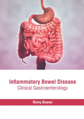 Zápalové ochorenie čriev: Klinická gastroenterológia - Inflammatory Bowel Disease: Clinical Gastroenterology