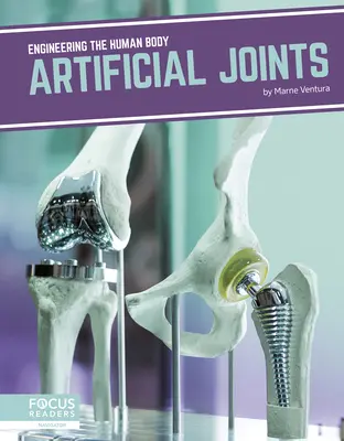 Umelé spoje - Artificial Joints