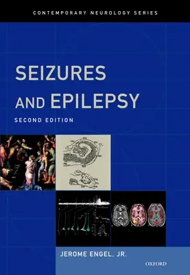 Záchvaty a epilepsia - Seizures and Epilepsy