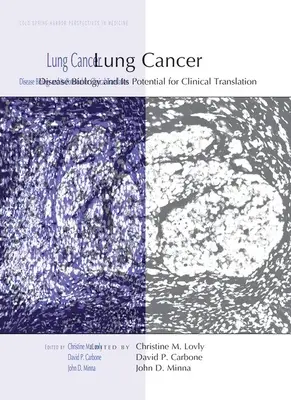 Rakovina pľúc: Biológia ochorenia a jej potenciál pre klinické využitie - Lung Cancer: Disease Biology and Its Potential for Clinical Translation