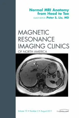 Normal MR Anatomy from Head to Toe, an Issue of Magnetic Resonance Imaging Clinics (Normálna MR anatómia od hlavy po päty): Volume 19-3 - Normal MR Anatomy from Head to Toe, an Issue of Magnetic Resonance Imaging Clinics: Volume 19-3