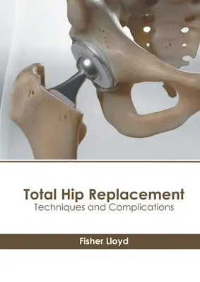 Totálna náhrada bedrového kĺbu: Techniky a komplikácie - Total Hip Replacement: Techniques and Complications