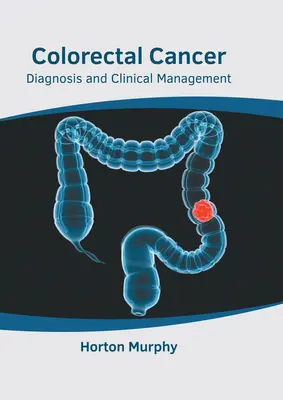 Kolorektálny karcinóm: Diagnostika a klinický manažment - Colorectal Cancer: Diagnosis and Clinical Management