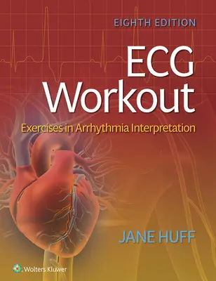 Cvičenie EKG: Cvičenia na interpretáciu arytmie - ECG Workout: Exercises in Arrhythmia Interpretation