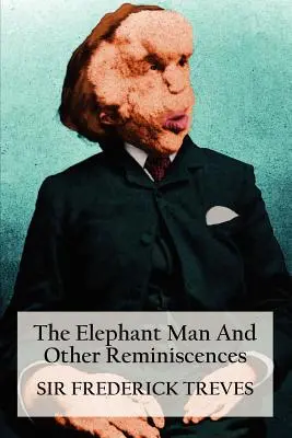 Sloní muž a iné spomienky - The Elephant Man and Other Reminiscences