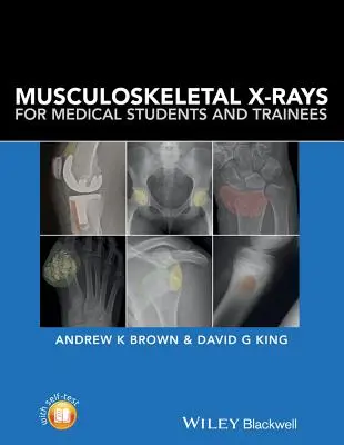 Röntgenové snímky pohybového aparátu pre študentov medicíny a stážistov - Musculoskeletal X-Rays for Medical Students and Trainees