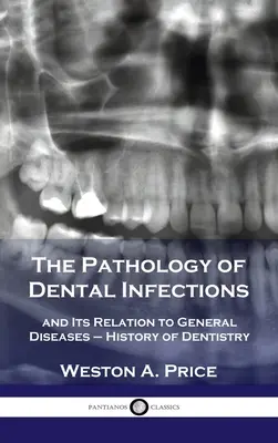 Patológia zubných infekcií: a jej vzťah k všeobecným chorobám - Dejiny zubného lekárstva - Pathology of Dental Infections: and Its Relation to General Diseases - History of Dentistry