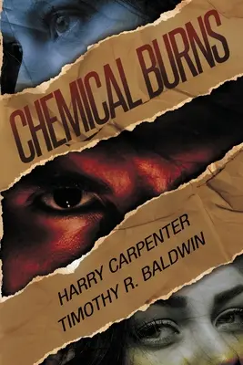 Chemické popáleniny - Chemical Burns