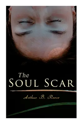Jazva na duši: Prípad detektíva Craiga Kennedyho - The Soul Scar: Detective Craig Kennedy's Case