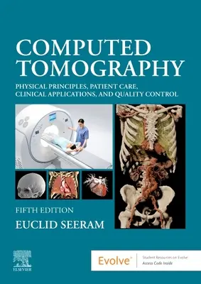 Počítačová tomografia: Fyzikálne princípy, starostlivosť o pacienta, klinické aplikácie a kontrola kvality - Computed Tomography: Physical Principles, Patient Care, Clinical Applications, and Quality Control