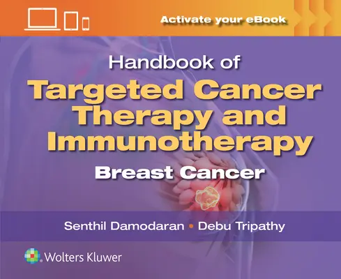 Príručka cielenej liečby rakoviny a imunoterapie: Rakovina prsníka: učebnica imunoterapie a imunitnej liečby - Handbook of Targeted Cancer Therapy and Immunotherapy: Breast Cancer