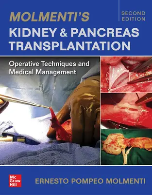 Molmentiho transplantácia obličiek a pankreasu: M.: Operačné techniky a medicínsky manažment - Molmenti's Kidney and Pancreas Transplantation: Operative Techniques and Medical Management