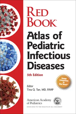 Červená kniha: Atlas detských infekčných chorôb (American Academy of Pediatrics (Aap)) - Red Book Atlas of Pediatric Infectious Diseases (American Academy of Pediatrics (Aap))