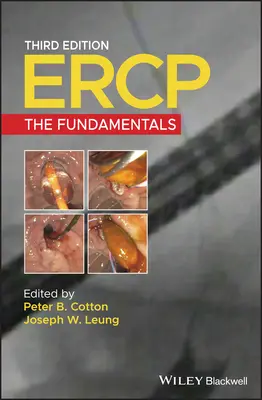 Ercp: Základy - Ercp: The Fundamentals