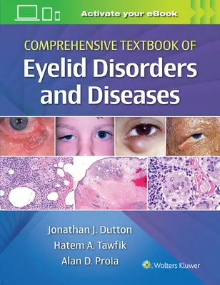 Komplexná učebnica porúch a chorôb očných viečok - Comprehensive Textbook of Eyelid Disorders and Diseases