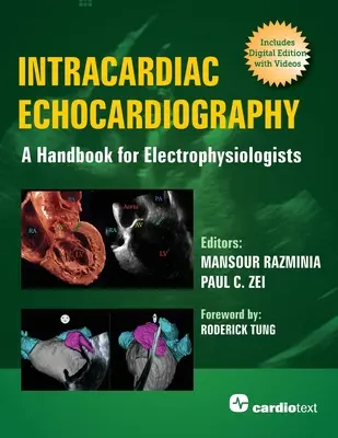 Intrakardiálna echokardiografia: Príručka pre elektrofyziológov - Intracardiac Echocardiography: A Handbook for Electrophysiologists