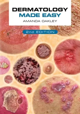 Jednoduchá dermatológia, druhé vydanie - Dermatology Made Easy, Second Edition
