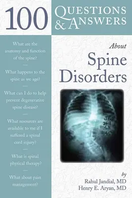 100 otázok a odpovedí o ochoreniach chrbtice - 100 Q&as about Spine Disorders