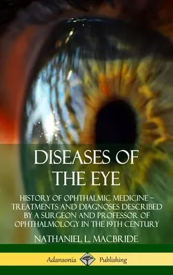 Choroby oka: História očnej medicíny - liečba a diagnózy opísané chirurgom a profesorom oftalmológie v - Diseases of the Eye: History of Ophthalmic Medicine - Treatments and Diagnoses Described by a Surgeon and Professor of Ophthalmology in the