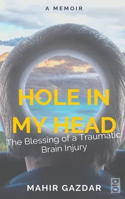 Diera v mojej hlave: Požehnanie traumatického poranenia mozgu - Hole in My Head: The Blessing of a Traumatic Brain Injury