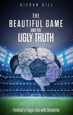 Krásna hra a škaredá pravda: tragické prepojenie futbalu s demenciou - The Beautiful Game and the Ugly Truth: Football's Tragic Link with Dementia