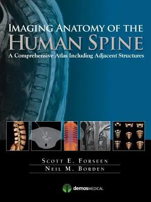 Zobrazenie anatómie ľudskej chrbtice: Komplexný atlas vrátane priľahlých štruktúr - Imaging Anatomy of the Human Spine: A Comprehensive Atlas Including Adjacent Structures