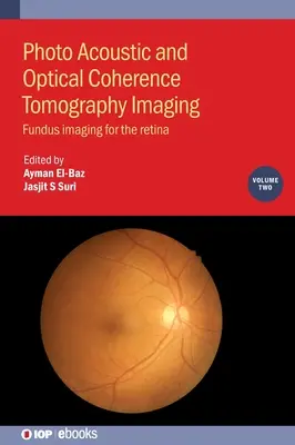 Fotoakustické a optické koherentné tomografické zobrazovanie, 2. diel - Photo Acoustic and Optical Coherence Tomography Imaging, Volume 2