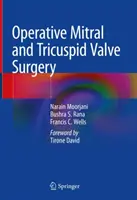 Operačná chirurgia mitrálnej a trikuspidálnej chlopne - Operative Mitral and Tricuspid Valve Surgery