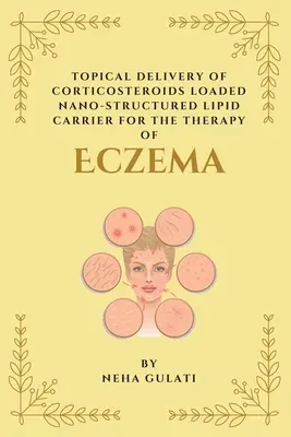 Lokálne podávanie kortikosteroidov naložených v nanoštruktúrovanom lipidovom nosiči na terapiu ekzému - Topical Delivery of Corticosteroids Loaded Nanostructured Lipid Carrier for the Therapy of Eczema