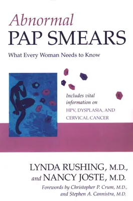 Abnormálne Pap stery: Čo potrebuje vedieť každá žena - Abnormal Pap Smears: What Every Woman Needs to Know