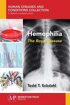 Hemophilia: Kráľovská choroba - Hemophilia: The Royal Disease