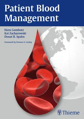 Manažment krvi pacientov - Patient Blood Management