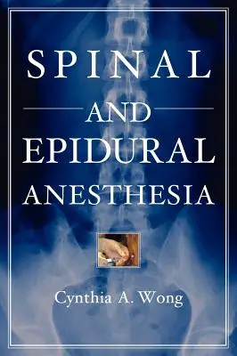 Spinálna a epidurálna anestézia - Spinal and Epidural Anesthesia