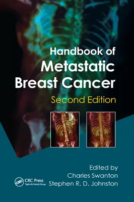 Príručka o metastatickej rakovine prsníka - Handbook of Metastatic Breast Cancer