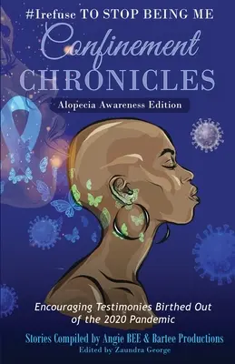 #Odmietnuť prestať byť mnou: Kroniky uzavretia - vydanie pre uvedomenie si alopécie - #Irefuse to Stop Being Me: Confinement Chronicles - Alopecia Awareness Edition