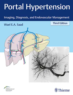 Portálna hypertenzia: Zobrazovanie, diagnostika a endovaskulárna liečba - Portal Hypertension: Imaging, Diagnosis, and Endovascular Management