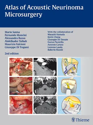 Atlas mikrochirurgie neurinómov akustiku - Atlas of Acoustic Neurinoma Microsurgery