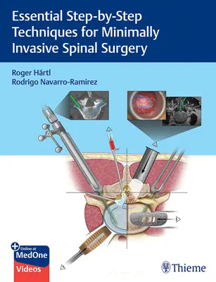 Základné techniky krok za krokom pri minimálne invazívnej chirurgii chrbtice - Essential Step-By-Step Techniques for Minimally Invasive Spinal Surgery
